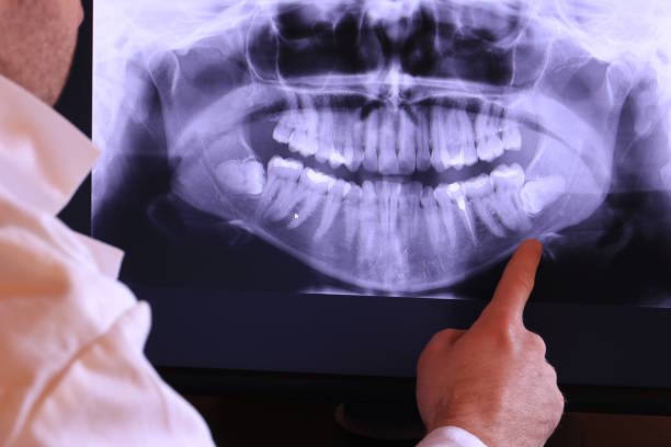 Best Dental Abscess Treatment in Hull, IA